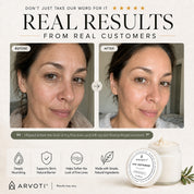 Promotional graphic for Arvoti Age Defense Skincare showing a before-and-after facial skin comparison, with text reading 'Real Results from Real Customers' and product jar imagery at the bottom.